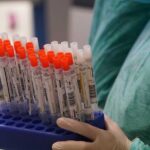 В Самарской области выявили еще 59 случаев коронавируса